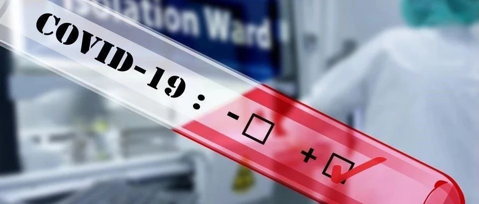 欧亚地区新冠病毒疫情简报（第六十二期）